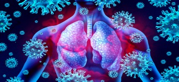 A Review of Infectious Pneumonias